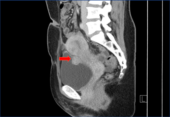 MRI 1.png