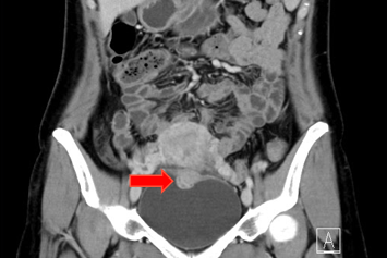 MRI 2.png