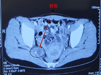 20251015525760.png 图片1.png